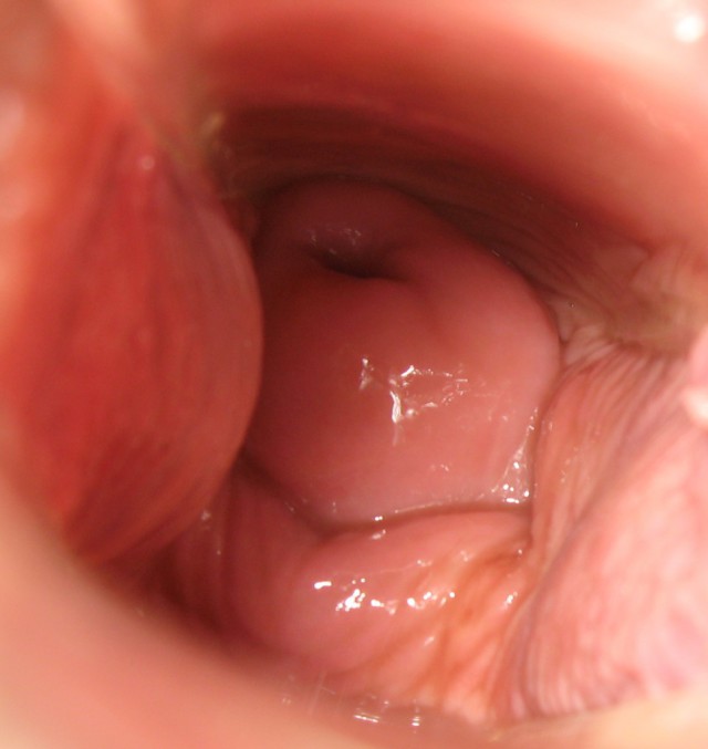 Cervixul văzut de jos, de la intrare în vagin (logic :D )